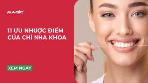 11 Ưu Nhược Điểm Của Chỉ Nha Khoa 2