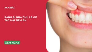 Răng Bị Nha Chu Là Gì? Tác Hại Tiềm Ẩn 2