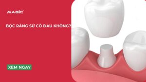Bọc Răng Sứ Có Đau Không? Quy Trình & Cách Chăm Sóc 11