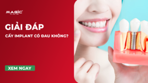 Cấy Implant Có Đau Không? Quá Trình Diễn Ra Như Thế Nào 26