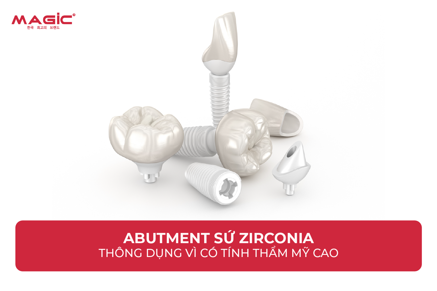9 Thông Tin Về Abutment Cá Nhân Cần Biết Trước Khi Làm 3