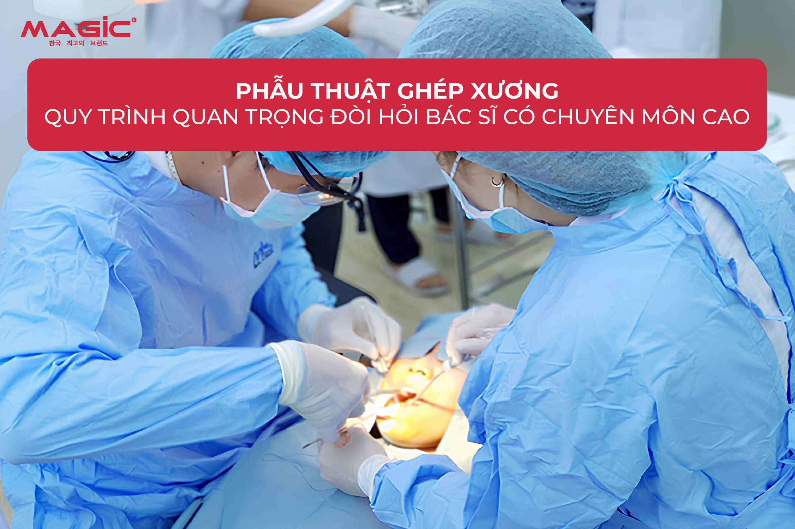 Ghép Xương Răng Là Gì? Khi Nào Cần Ghép Xương Răng 5 Ghép Xương Răng Là Gì? Khi Nào Cần Ghép Xương Răng 5