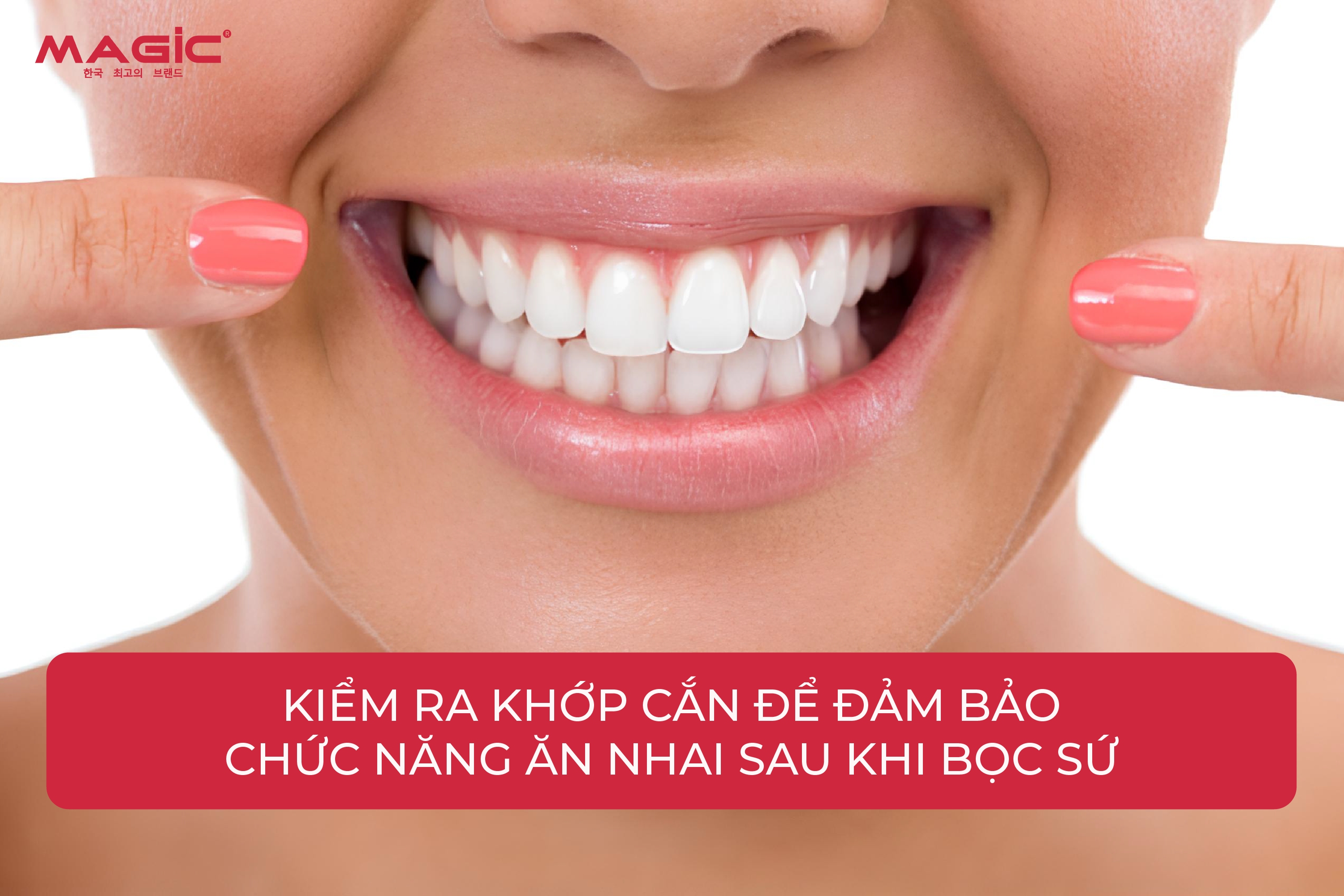 9 Bước Trong Quy Trình Làm Răng Sứ 6 9 Bước Trong Quy Trình Làm Răng Sứ 6