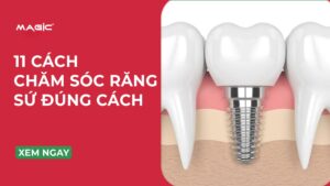 11 Cách Chăm Sóc Răng Sứ Đúng Cách Chuẩn Nha Khoa 2