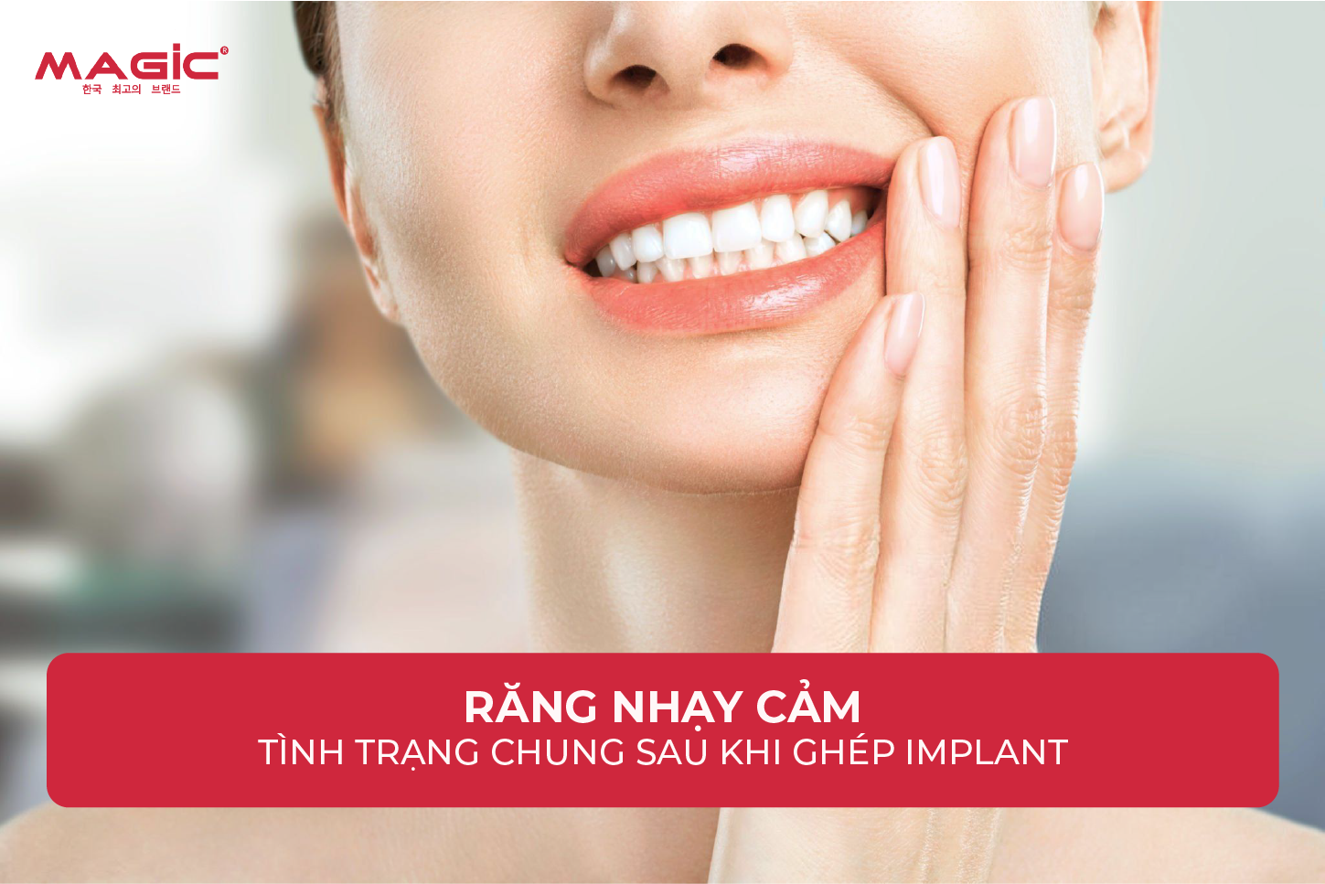 Từ A-Z Cấy Ghép Implant Là Gì? Nên Nắm Rõ Trước Khi Làm 9