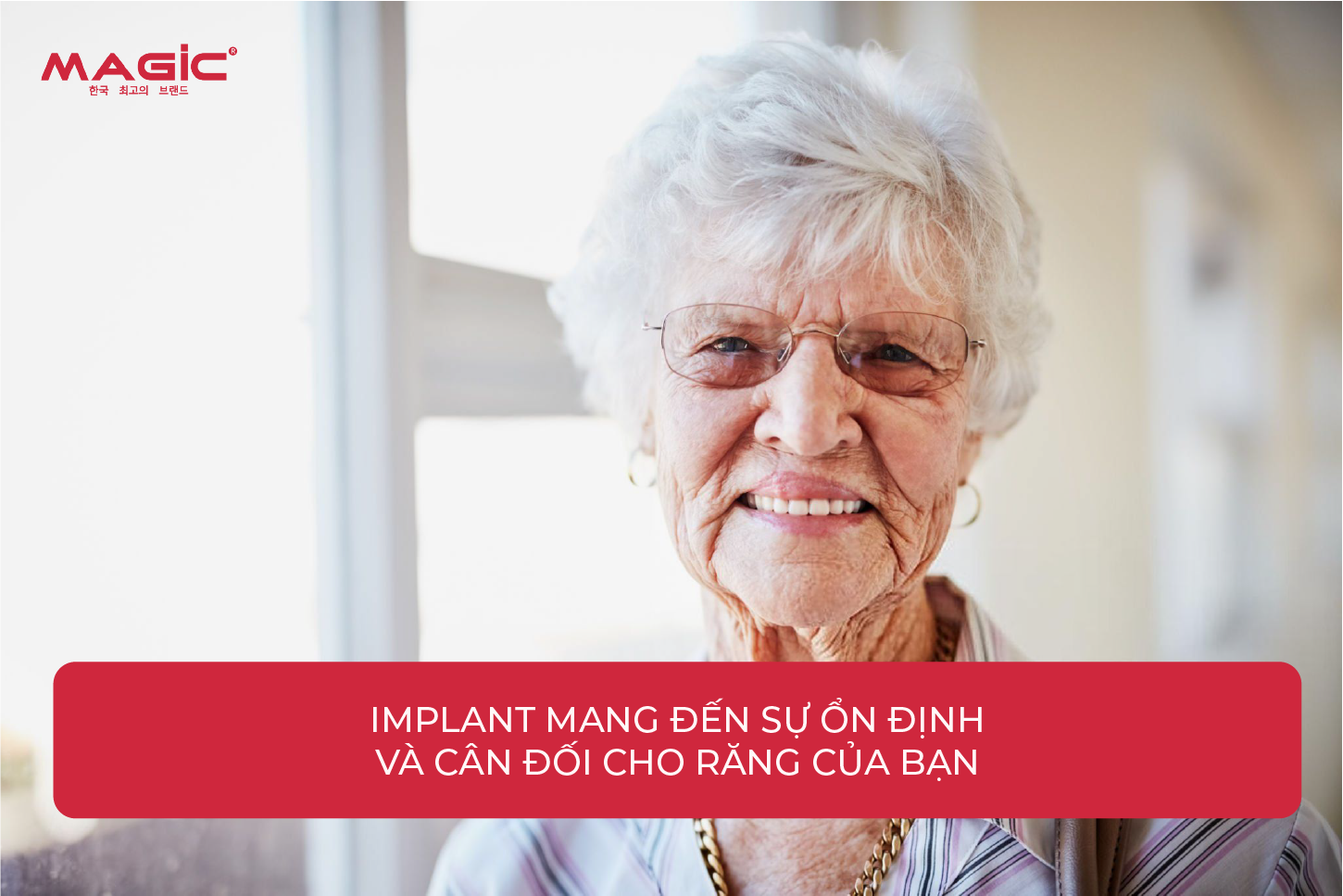 Từ A-Z Cấy Ghép Implant Là Gì? Nên Nắm Rõ Trước Khi Làm 10