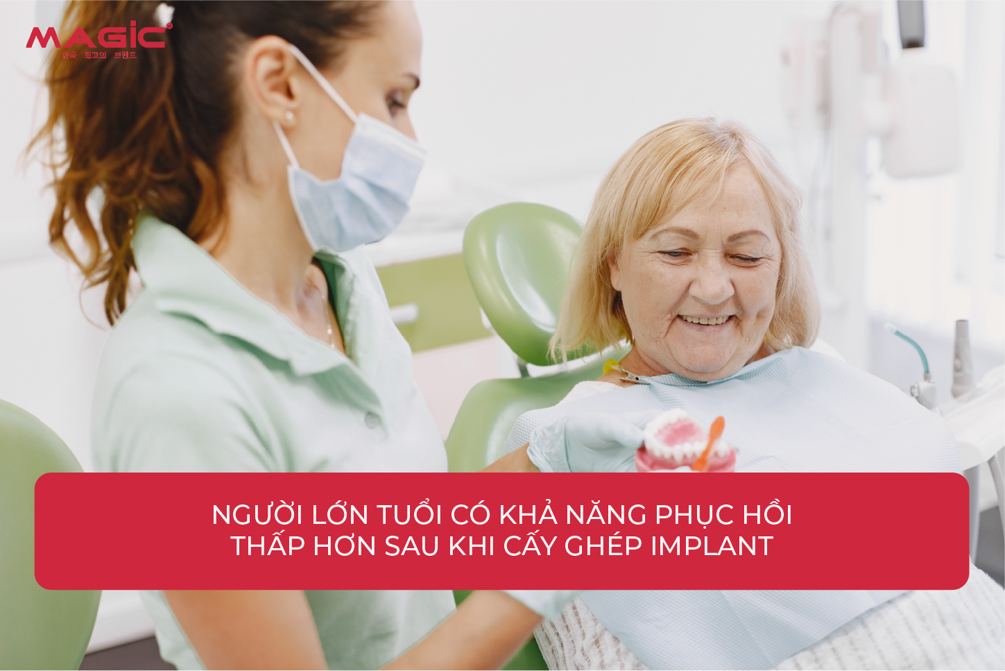 Từ A-Z Cấy Ghép Implant Là Gì? Nên Nắm Rõ Trước Khi Làm 5