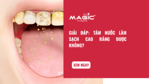 Giải Đáp: Tăm Nước Làm Sạch Cao Răng Được Không? 1 Giải Đáp: Tăm Nước Làm Sạch Cao Răng Được Không? 1