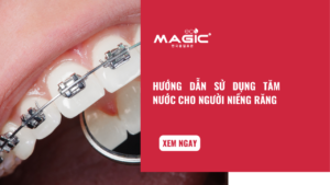 Hướng Dẫn Sử Dụng Tăm Nước Cho Người Niềng Răng 4 Hướng Dẫn Sử Dụng Tăm Nước Cho Người Niềng Răng 4