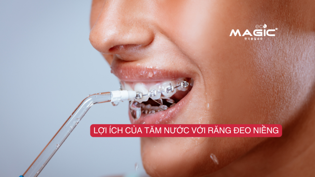 Hướng Dẫn Sử Dụng Tăm Nước Cho Người Niềng Răng 2 Hướng Dẫn Sử Dụng Tăm Nước Cho Người Niềng Răng 2